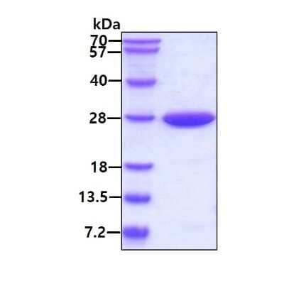 SDS-PAGE: Recombinant Human RhoGDI His Protein [NBP1-50861]